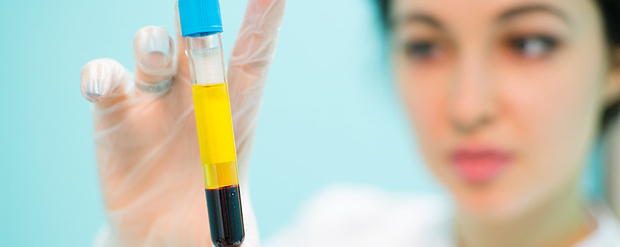 Platelet Rich Plasma Tampa PRP Injection, Therapy