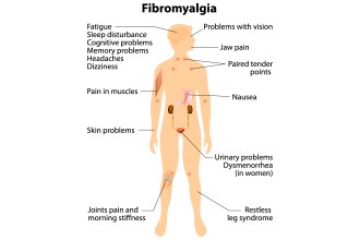 Fibromyalgia Tampa Natural Pain Relief Treatment For Fibromyalgia Tampa The Villages